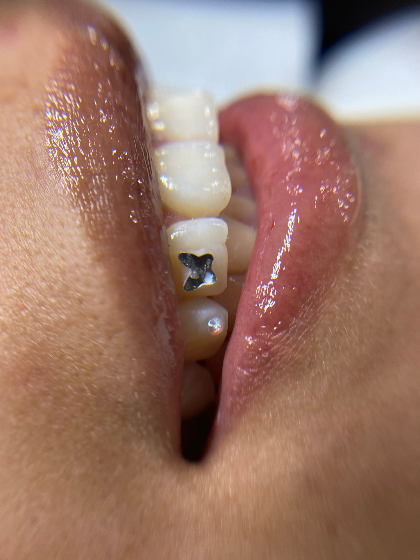 DOSSIER GEMAS DENTALES