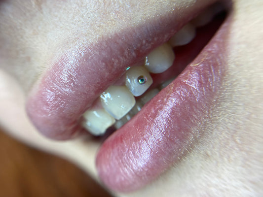 LAS PALMAS - GEMAS DENTALES