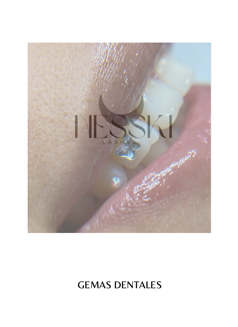 CURSO ONLINE GEMAS DENTALES