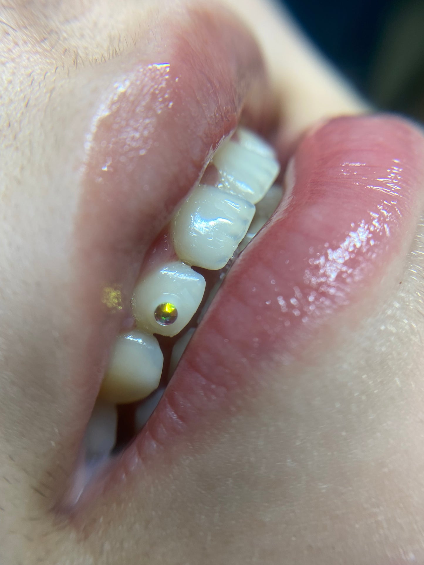 CURSO ONLINE GEMAS DENTALES