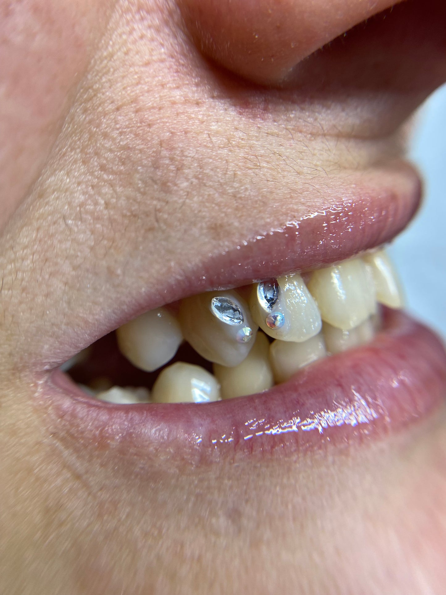 DOSSIER GEMAS DENTALES